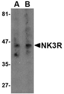 NK3R Antibody