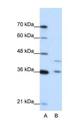 NKD2 antibody