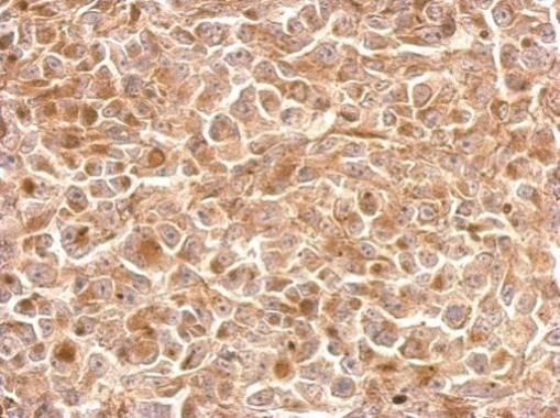 NKG2A Rabbit Polyclonal Antibody