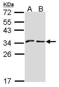 NKG2A Rabbit Polyclonal Antibody