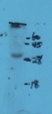 NKp44 antibody
