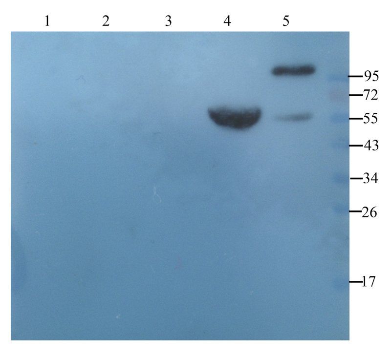 NKp44 antibody