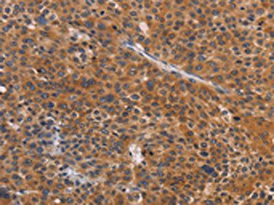 NKp46 antibody