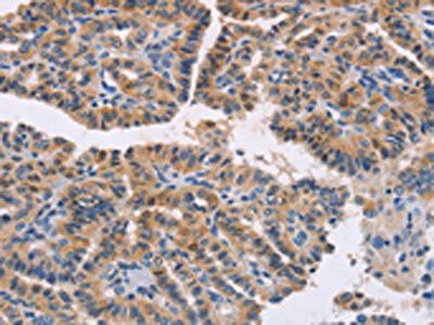 NKp46 antibody