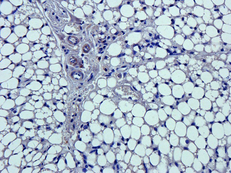 NKp46 antibody