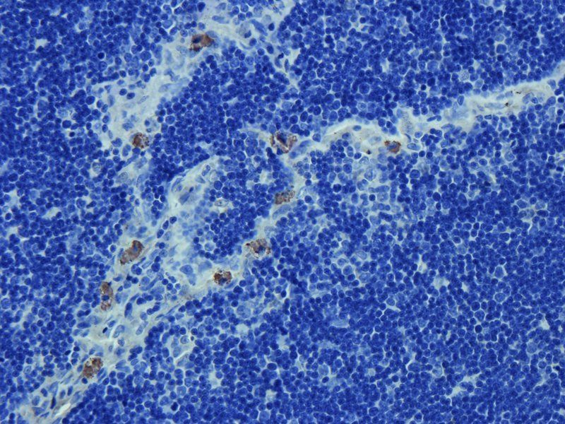 NKp46 Rabbit Polyclonal Antibody