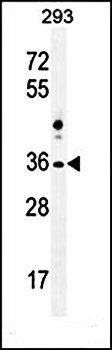 NKX1-2 antibody