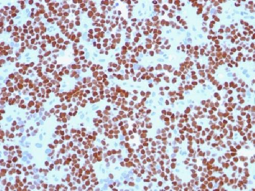 NKX2.2 (Neuroendocrine & Ewing's Sarcoma Marker) Antibody