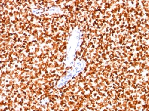 NKX2.2 (Neuroendocrine & Ewing Sarcoma Marker) Antibody