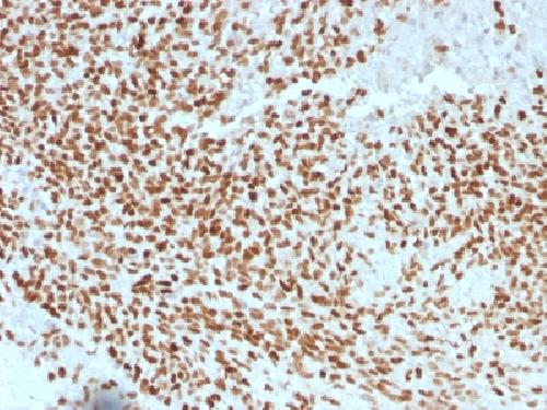 NKX2.2 (Neuroendocrine & Ewing's Sarcoma Marker) Antibody