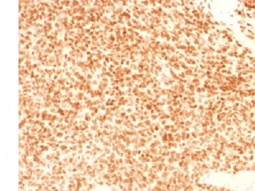 NKX2.2 (Neuroendocrine & Ewing's Sarcoma Marker) Antibody