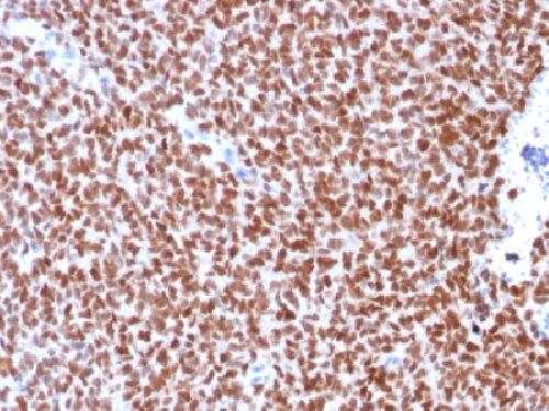 Recombinant NKX2.2 (Neuroendocrine & Ewing's Sarcoma Marker) Antibody