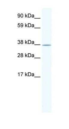 NKX2-3 antibody