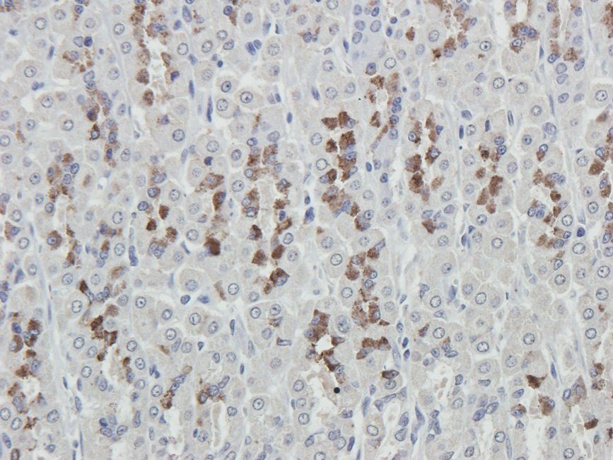 NKX2-5 antibody