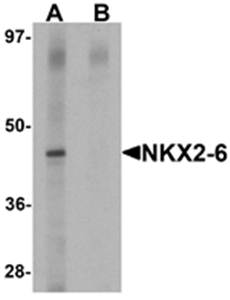 NKX2-6 Antibody