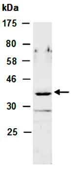 NKX2 antibody