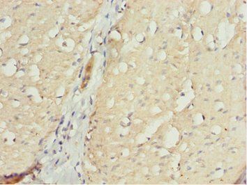 NLE1 Antibody