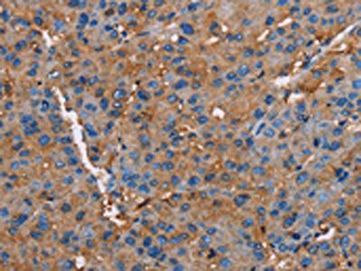 NLGN1 Antibody
