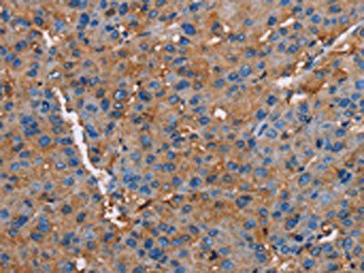 NLGN1 antibody