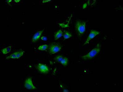 NLGN3 antibody