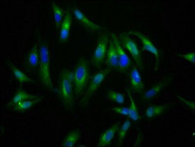 NLGN4X Antibody