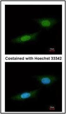 NLK antibody [N3C3]