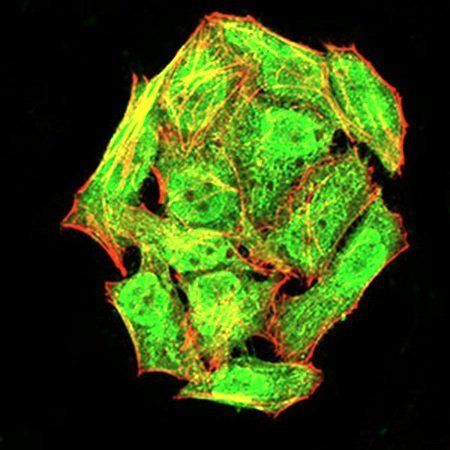 NLRC4 (phospho-Ser-533)