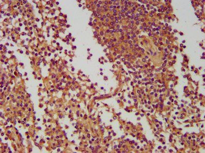 NLRC5 Antibody