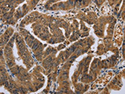 NLRP10 Antibody