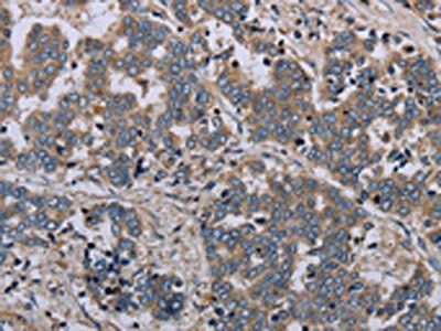 NLRP12 antibody