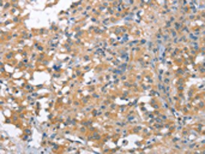 NLRP7 antibody