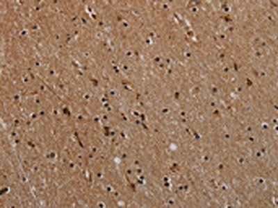 NLRP9 Antibody
