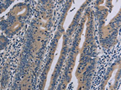 NLRP9 Antibody