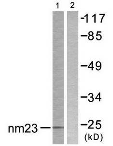 NM23 antibody