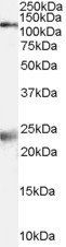 Goat anti-NMDA receptor 1 / GRIN1 Antibody