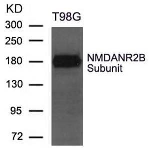 NMDANR2B Subunit Antibody