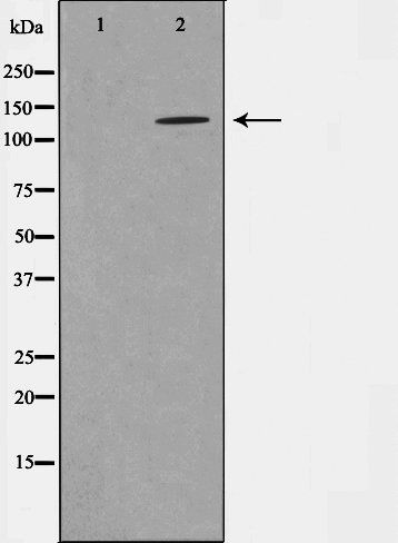NMDAR1 (Phospho-Ser897) antibody
