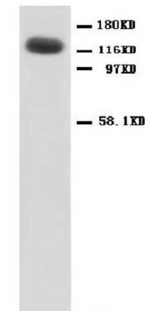 NMDAR1/GRIN1 Antibody
