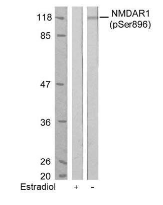 NMDAR1 (Phospho-Ser896) Antibody