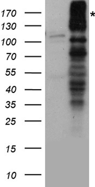 NMDAR2A (GRIN2A) antibody