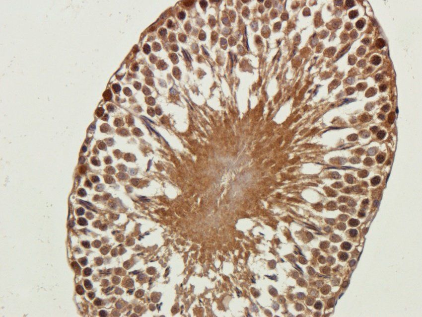 NMDE2 antibody