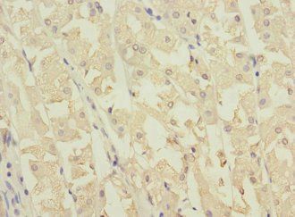 NME3 Antibody