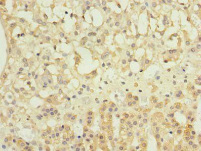NME7 Antibody