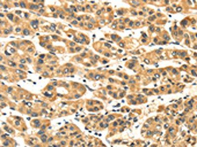 NME8 Antibody