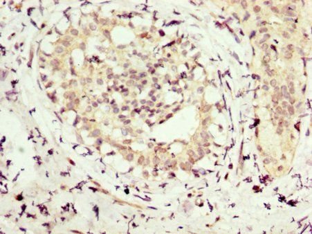 NMT1 antibody