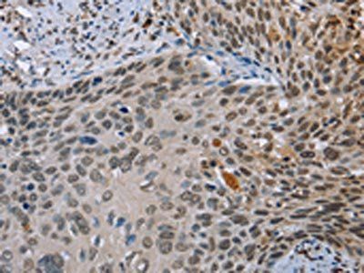 NMT1 Antibody