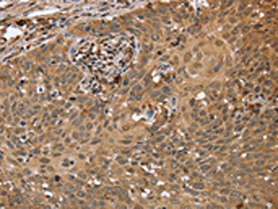 NMT1 Antibody
