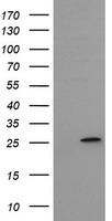 NMT2 antibody