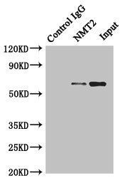 NMT2 antibody