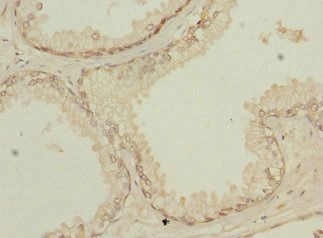 NMT2 antibody